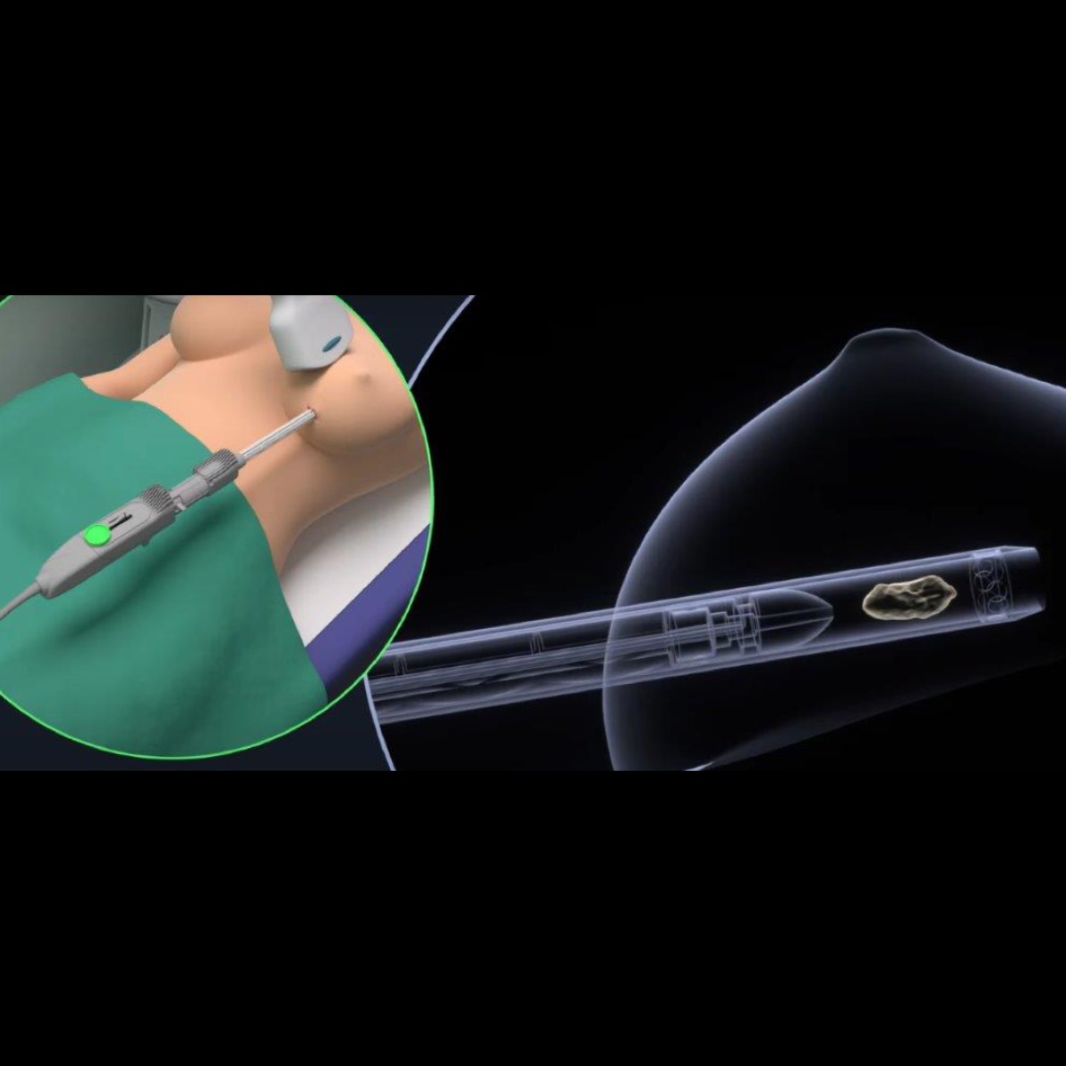 Image for card with title 